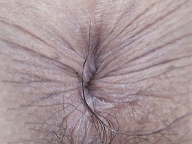 300人の尻穴 第2集　サンプル画像12